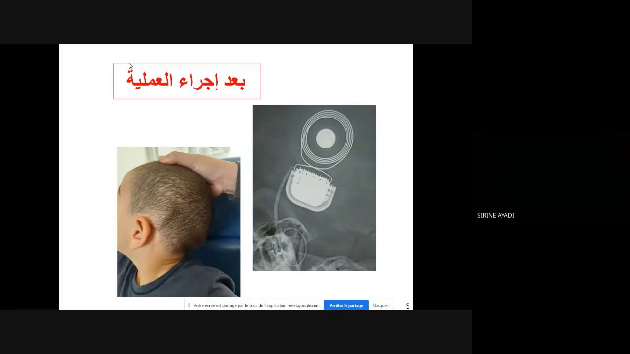 زراعة القوقعة في تونس ملتقى علمي تحسيسي