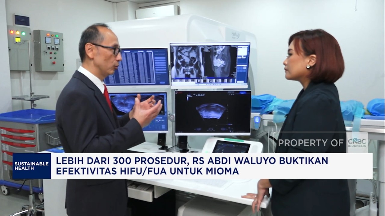300 Prosedur HIFU/FUA RS Abdi Waluyo: Solusi Mioma Tanpa Operasi