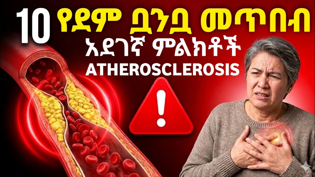 በዝምታ የሚገድለው የደም ሥር መጥበብ (Atherosclerosis)፦ ሳይረፍድባችሁ እነዚህን 10 ምልክቶች እወቁ!