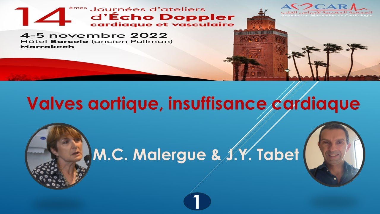 14émes Journées d'Ateliers d'Echo Doppler cardiaque et vasculaire