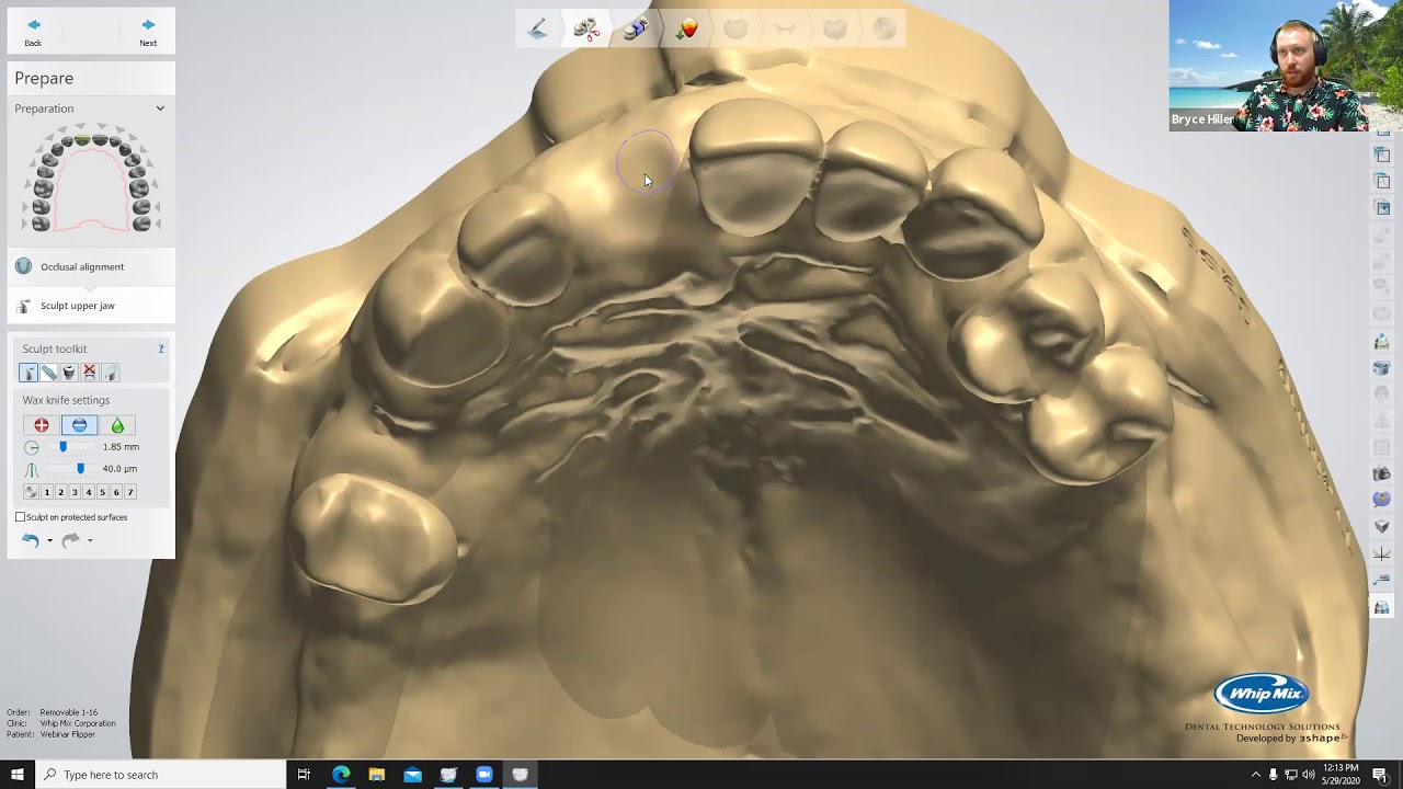 Digital Dentistry Training Series: RPD Flipper Design