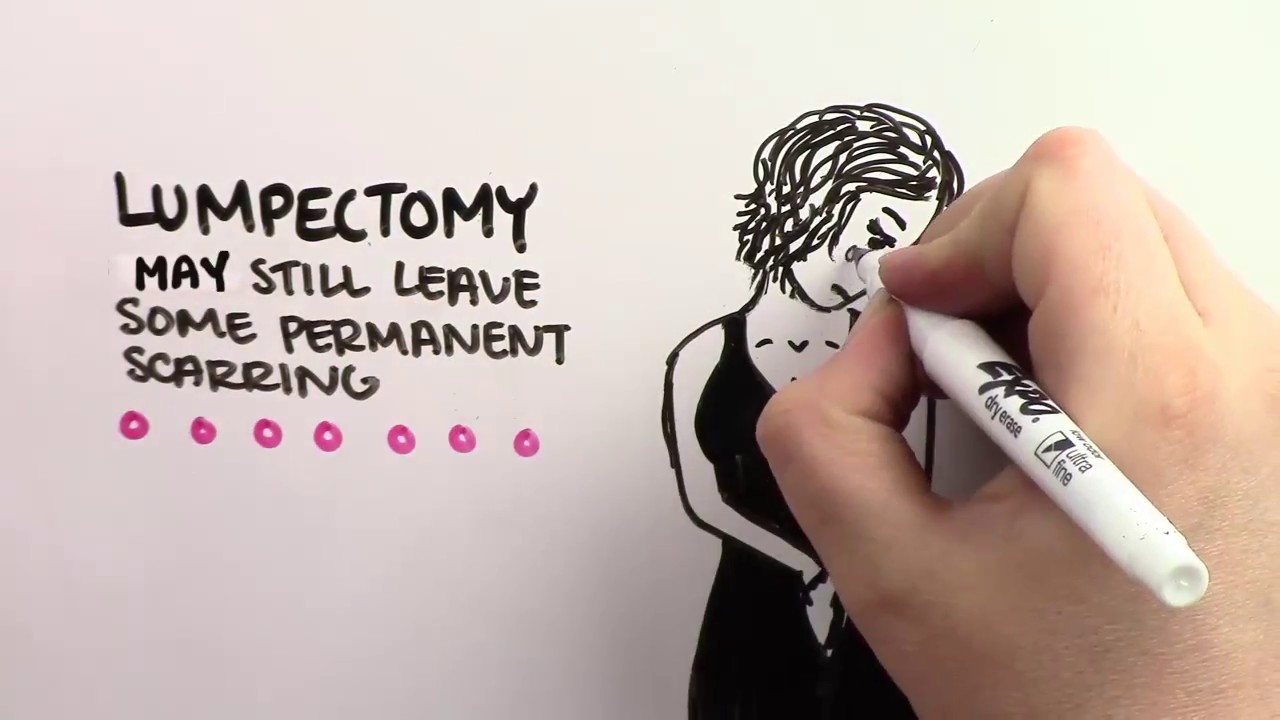 Hidden Scar Lumpectomy at Wellstar