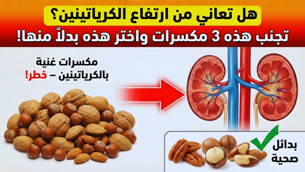 الكرياتينين مرتفع جدًا؟ تجنّب 3 مكسرات “شائعة” واستبدلها بـ3 خيارات ألطف على الكلى!