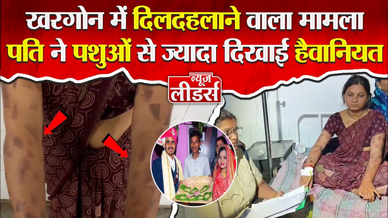 News Leaders - खरगोन में बेटियां नहीं है सुरक्षित, ज़ालिम ने यह क्या किया देखिए पूरी रिपोर्ट 