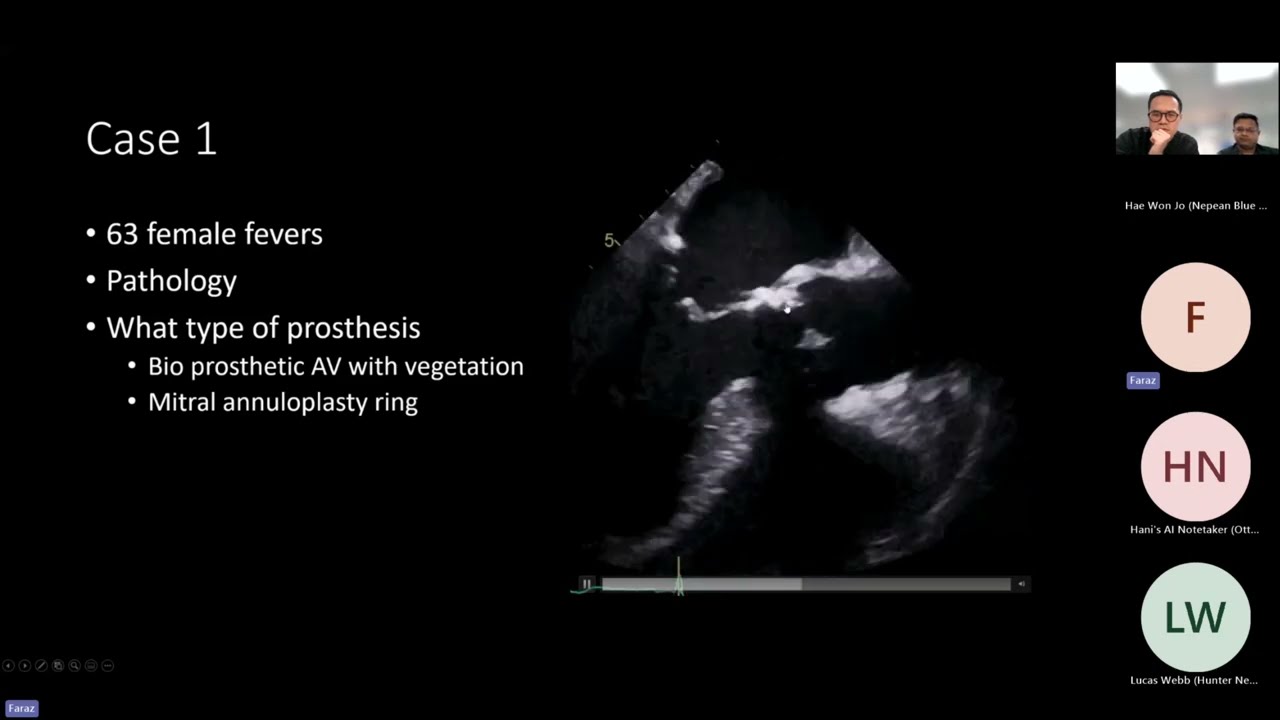 Prosthetic valve assessment