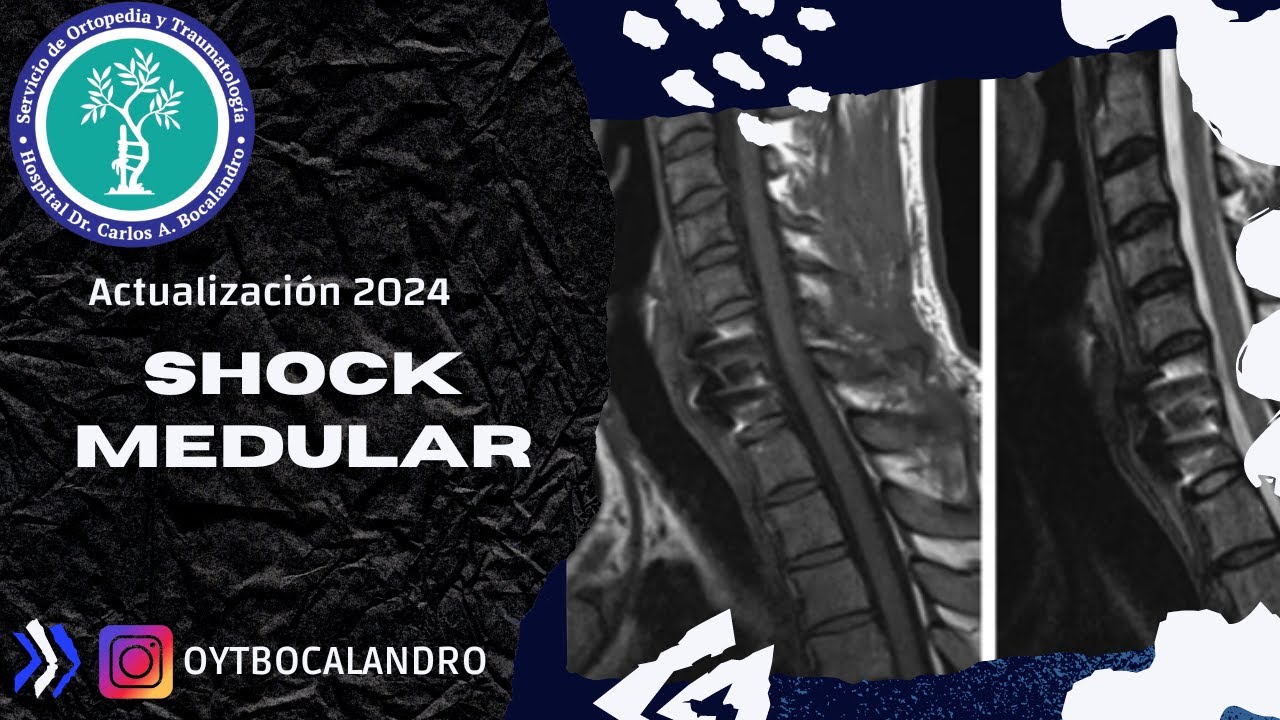 Shock Medular