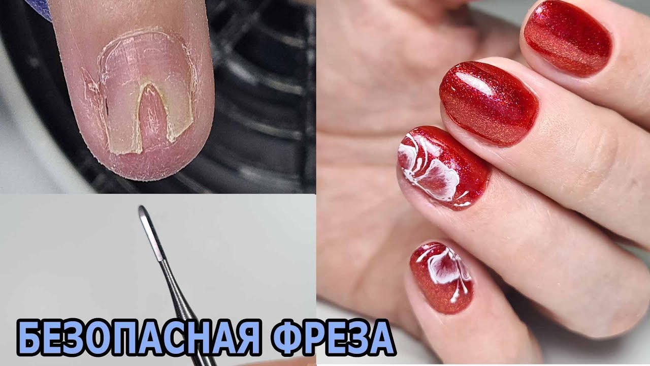 ❤ продолжение ОНИХОЛИЗИС ❤ БЕЗОПАСНАЯ фреза Oney clean КАК РАБОТАТЬ ❤ СЛОЖНАЯ работа ❤