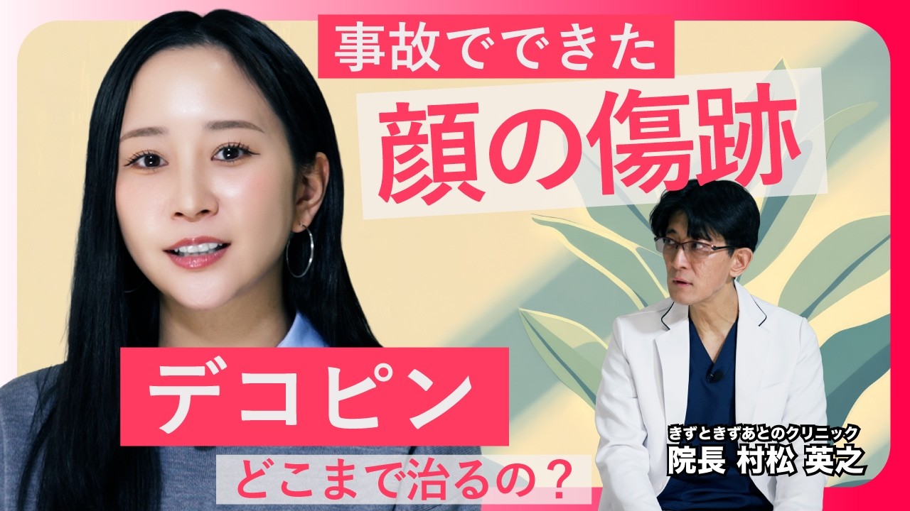【デコピン×村松英之】交通事故でできた顔の傷跡はどこまで治せる？！