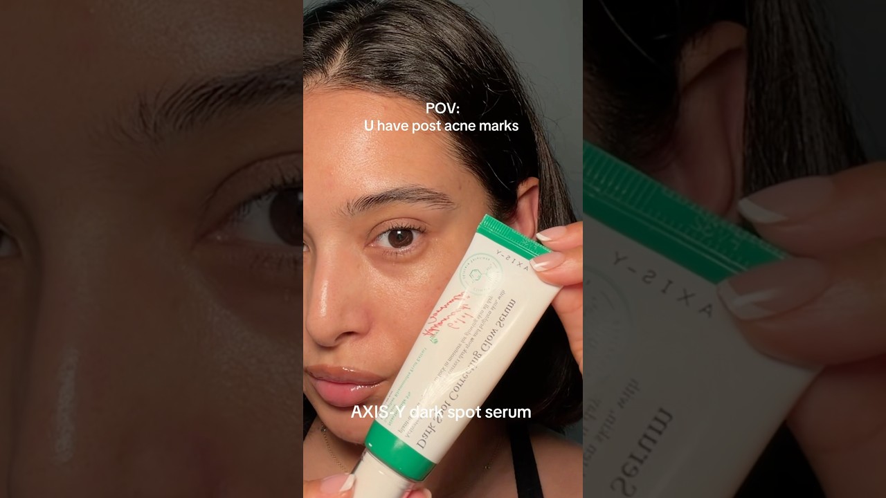 Axis-y dark spot serum for post acne marks.