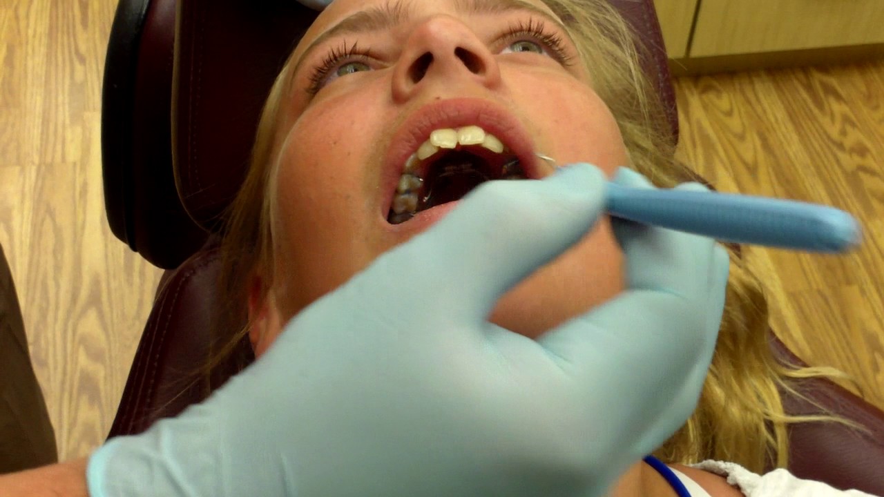 How to: Adjust the Palatal Expander (PE) Key - Banasiak & Nettune Orthodontic Associates