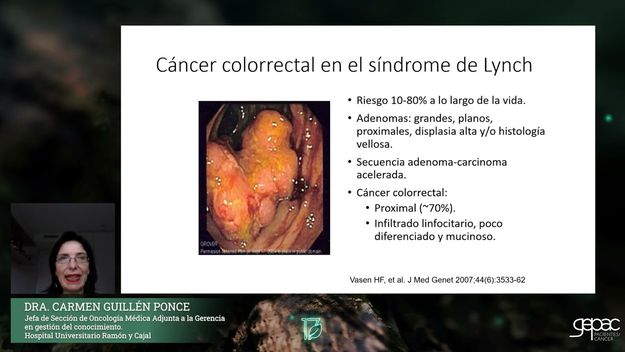 Síndrome de Lynch: diagnóstico, tratamiento y consejo reproductivo - Dra. Carmen Guillén Ponce