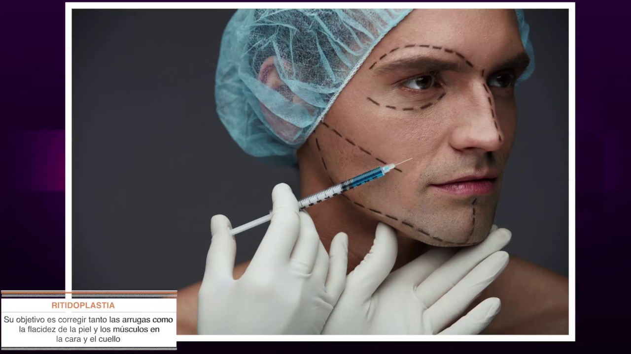 Ritidoplastia - Rejuvenecimiento Facial para toda la Cara por el Dr. Julio Gil