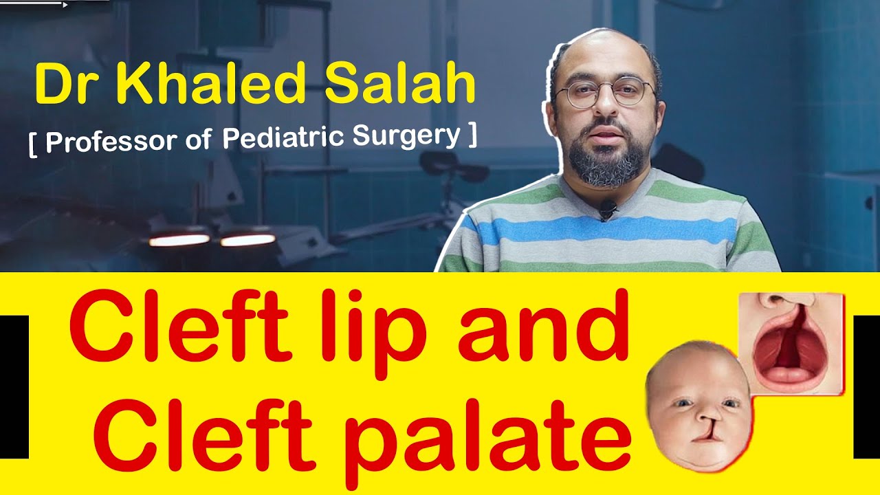 Cleft lip and cleft palate -  Dr. Khaled Salah -   الشفة الأرنبية وشق سقف الحلق توقيت العمليات