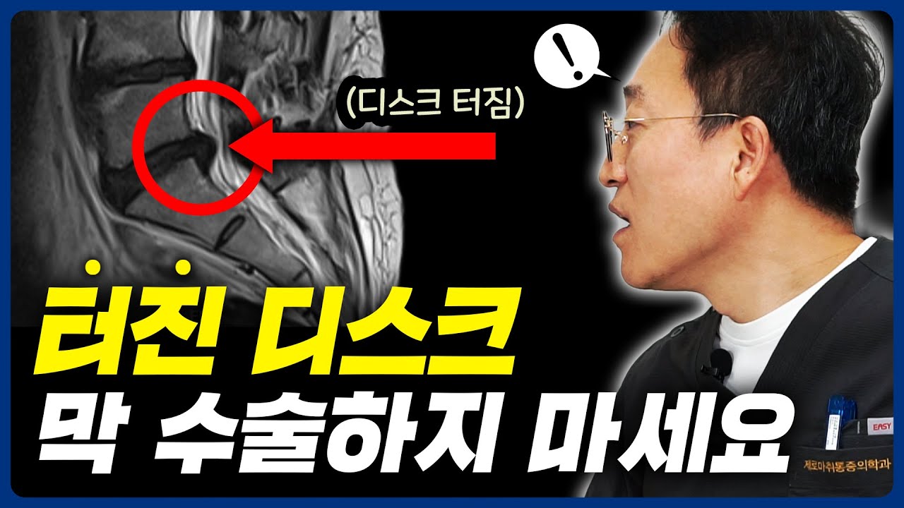 허리 디스크 파열로 수술하는 시대는 지났습니다