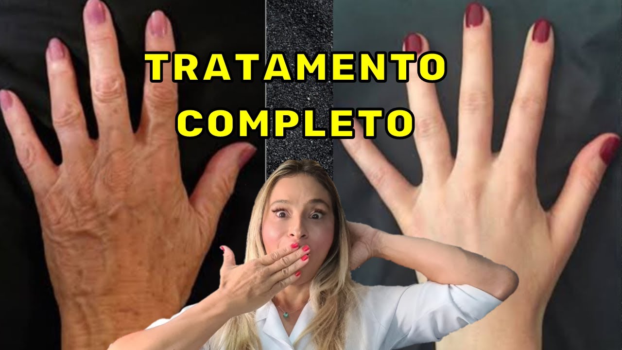 MÃOS Jovens, Macias e sem Manchas a Vida Inteira! Trate no Outono/ Inverno!