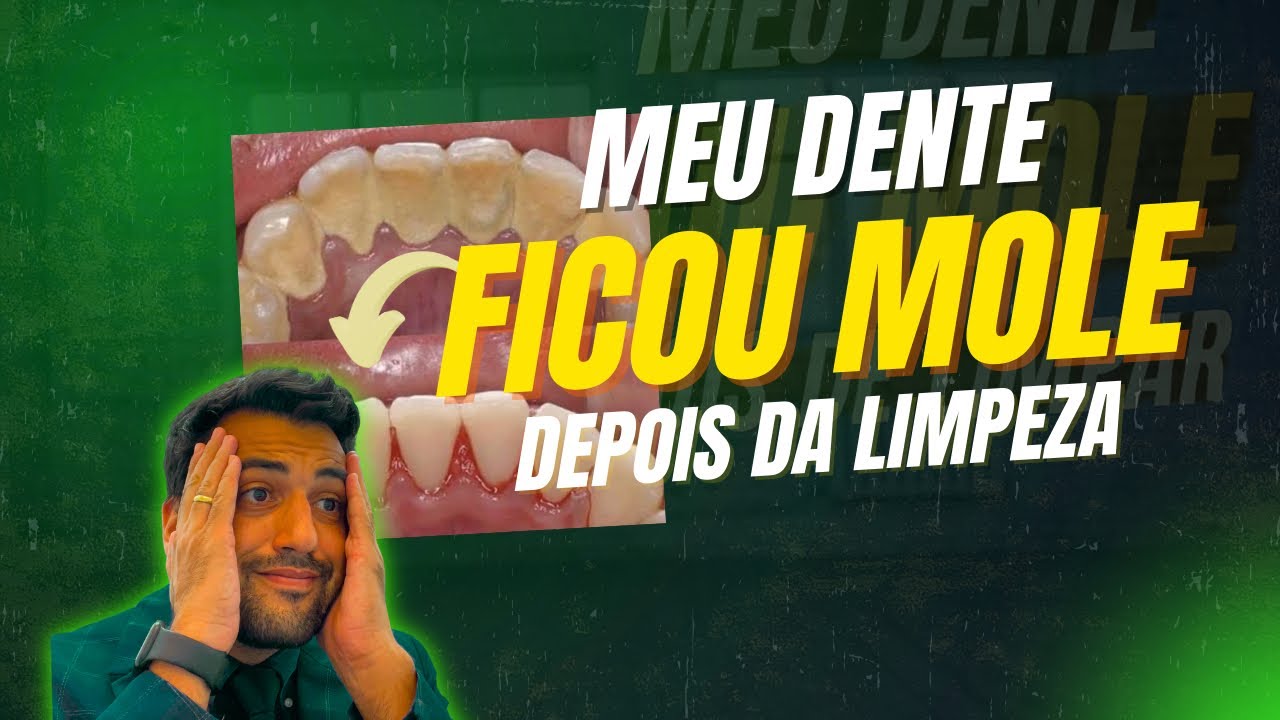 Meu Dente Ficou MOLE depois da LIMPEZA!