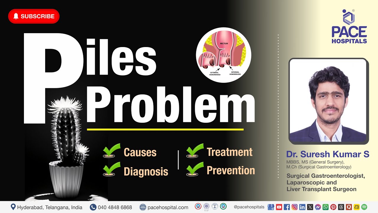 Piles Problem - Causes, Symptom, Diagnosis, Treatment and Prevention #piles