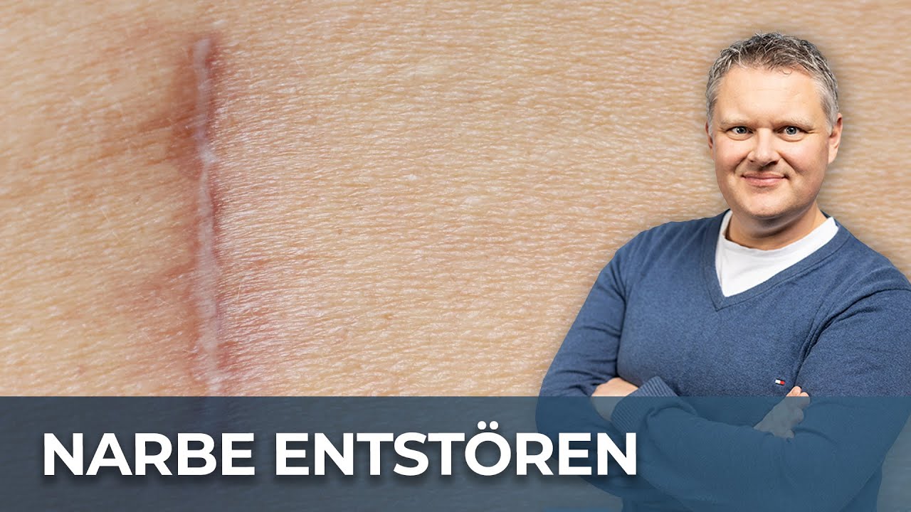 Narbe entstören durch massieren - so leicht geht's