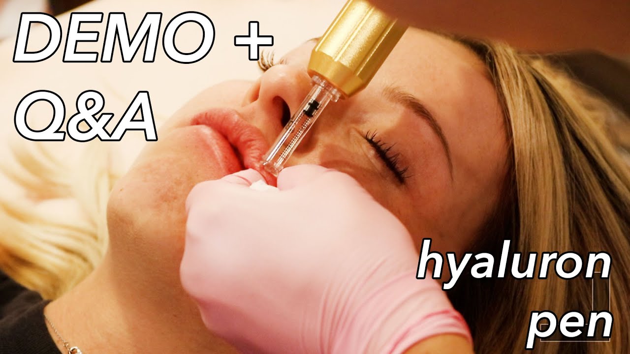 Hyaluron Pen Lip Infusion Demo + Q&A | Alana LaRubio