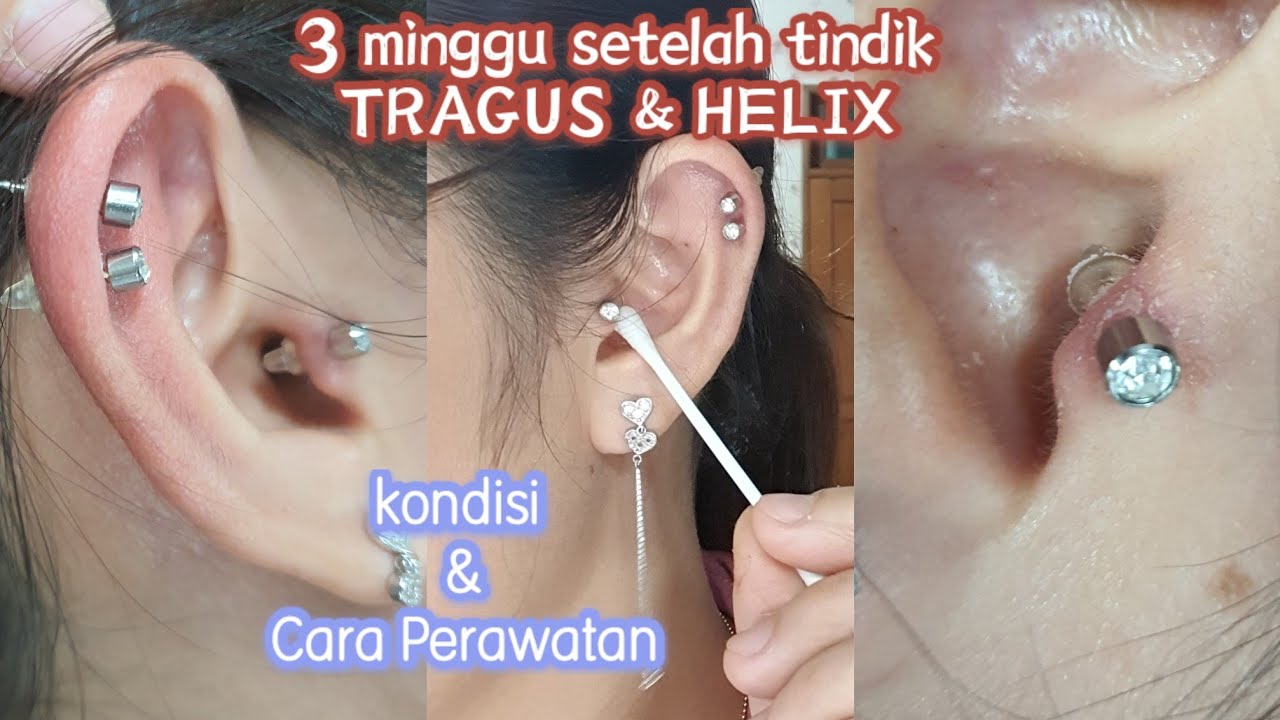 3 minggu setelah tindik tragus dan Helix