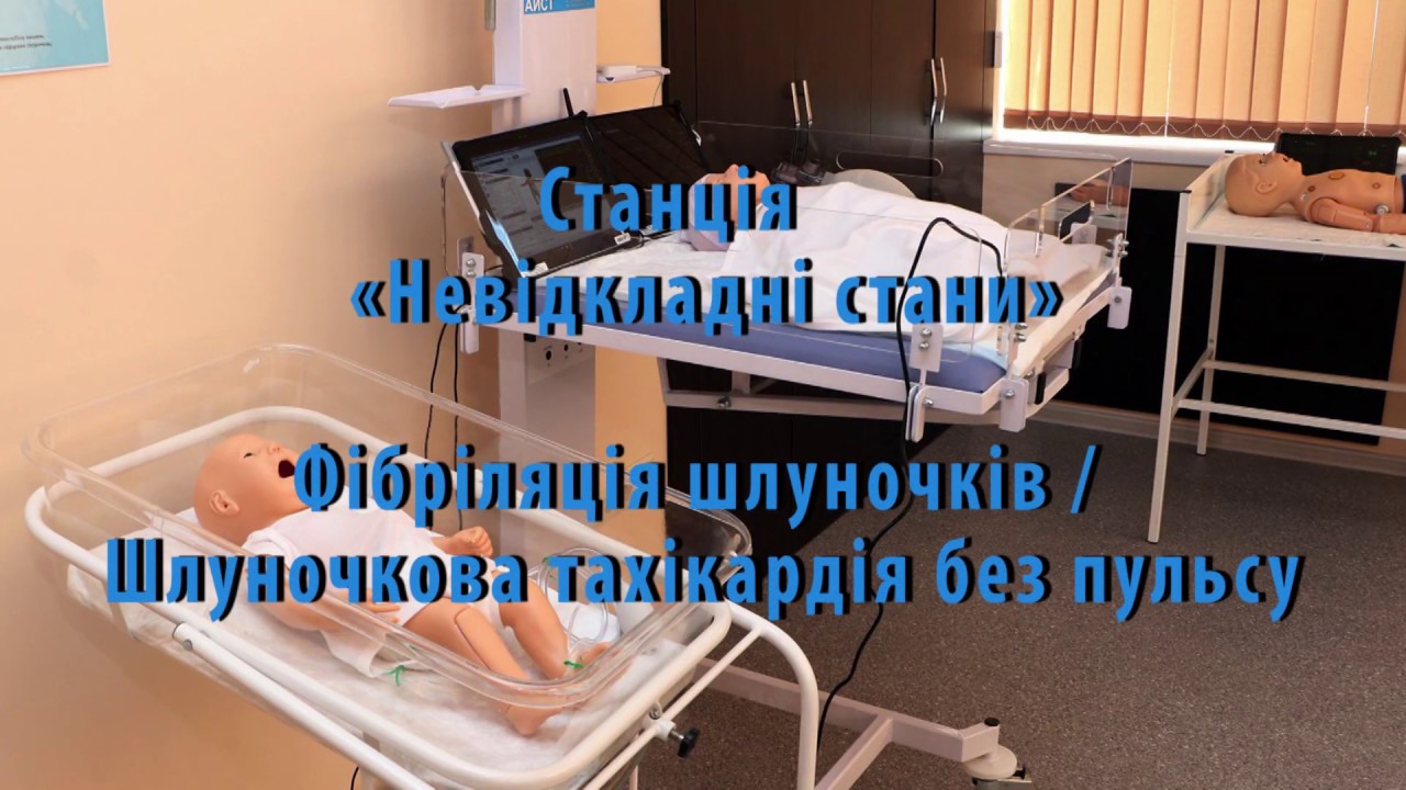 Фібріляція шлуночків