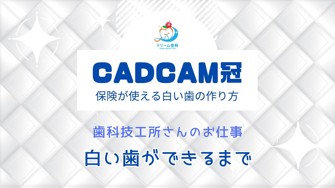 CADCAM冠　歯科技工所さんのお仕事　白い歯ができるまで【ドリーム歯科】#ドリーム歯科 #沖縄県 #中城村 #公式YouTube #技工士 #歯科技工士 #CADCAM冠 #歯科技工所 #模型作り