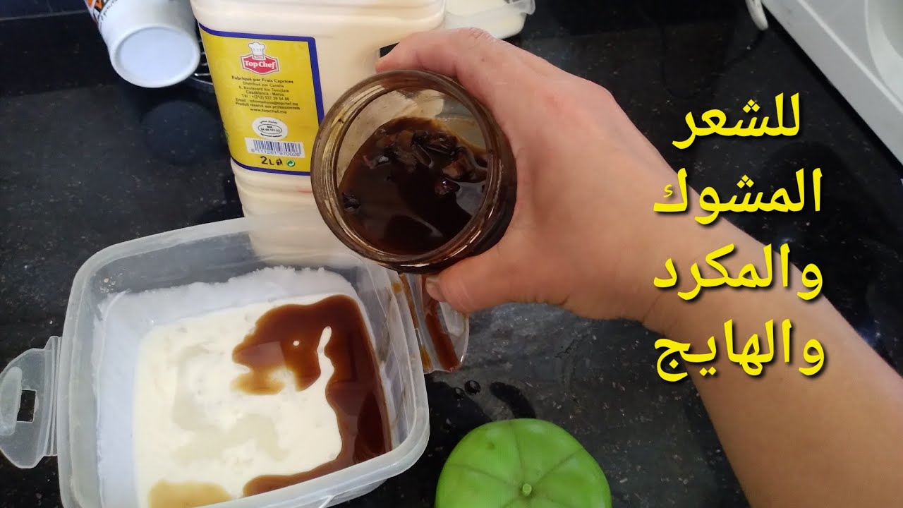 والله القسم منخبيها عليكم ولا خسارة فيكم شعرنا كيولي حالتو فهاد الصيف بالشمس وملح البحر /علاج الجذري