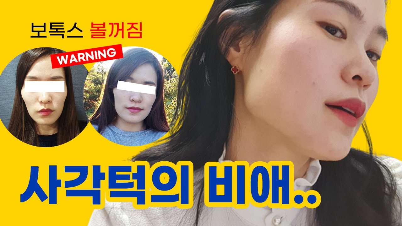 평생 사각턱, 외모콤플렉스에 시달렸다면?! 😂