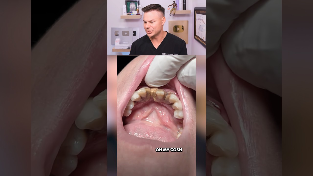 What Happens If You NEVER Brush Your Teeth! 😮🦷