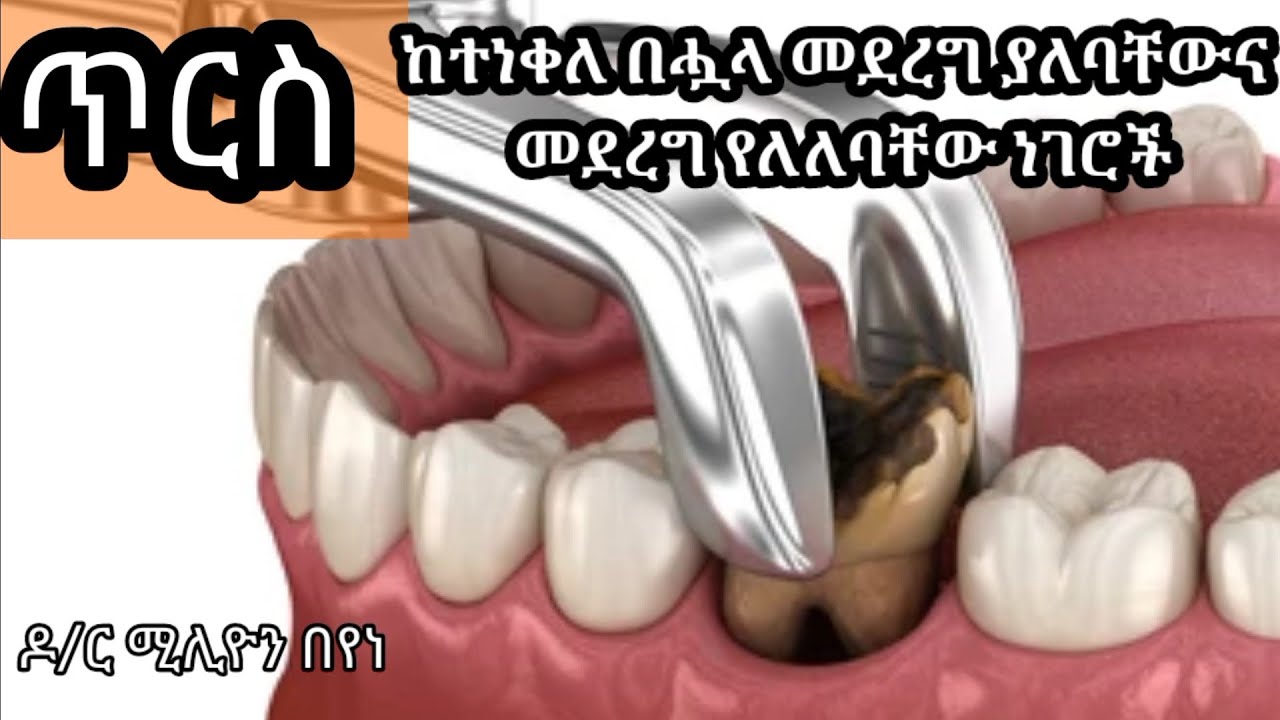 ጥርስ ከተነቀለ በሗላ መደረግ ያለባቸውና መደረግ የለለባቸው ነገሮች@ዶርሚሊዮንDrMillion