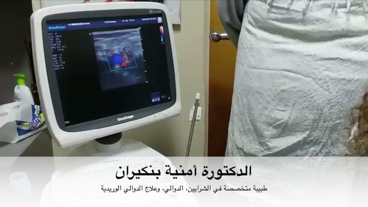الدكتورة أمنية بنكيران : الفحص بالصدى ضروري وإلزامي للكشف على الدوالي وضمان علاج ناجع