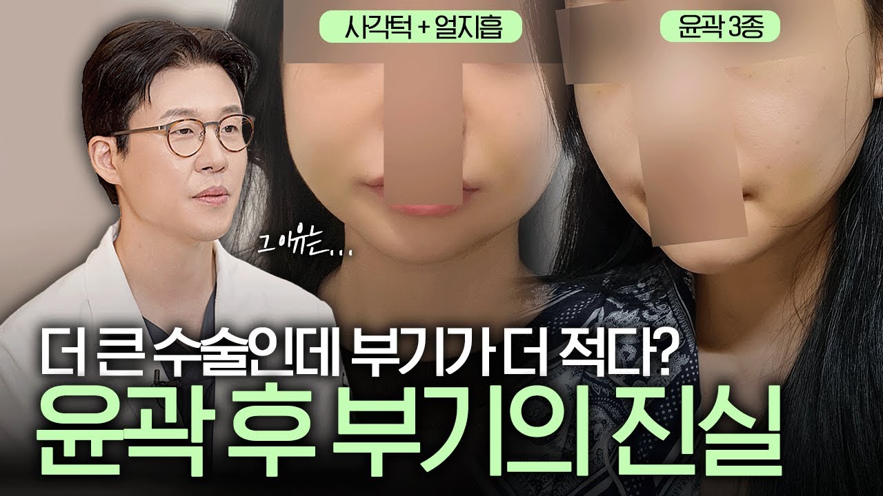 사각턱 수술보다 윤곽3종이 부기가 더 적은 이유⁉️ 윤곽수술 후 부기는 이것이 포인트!✨