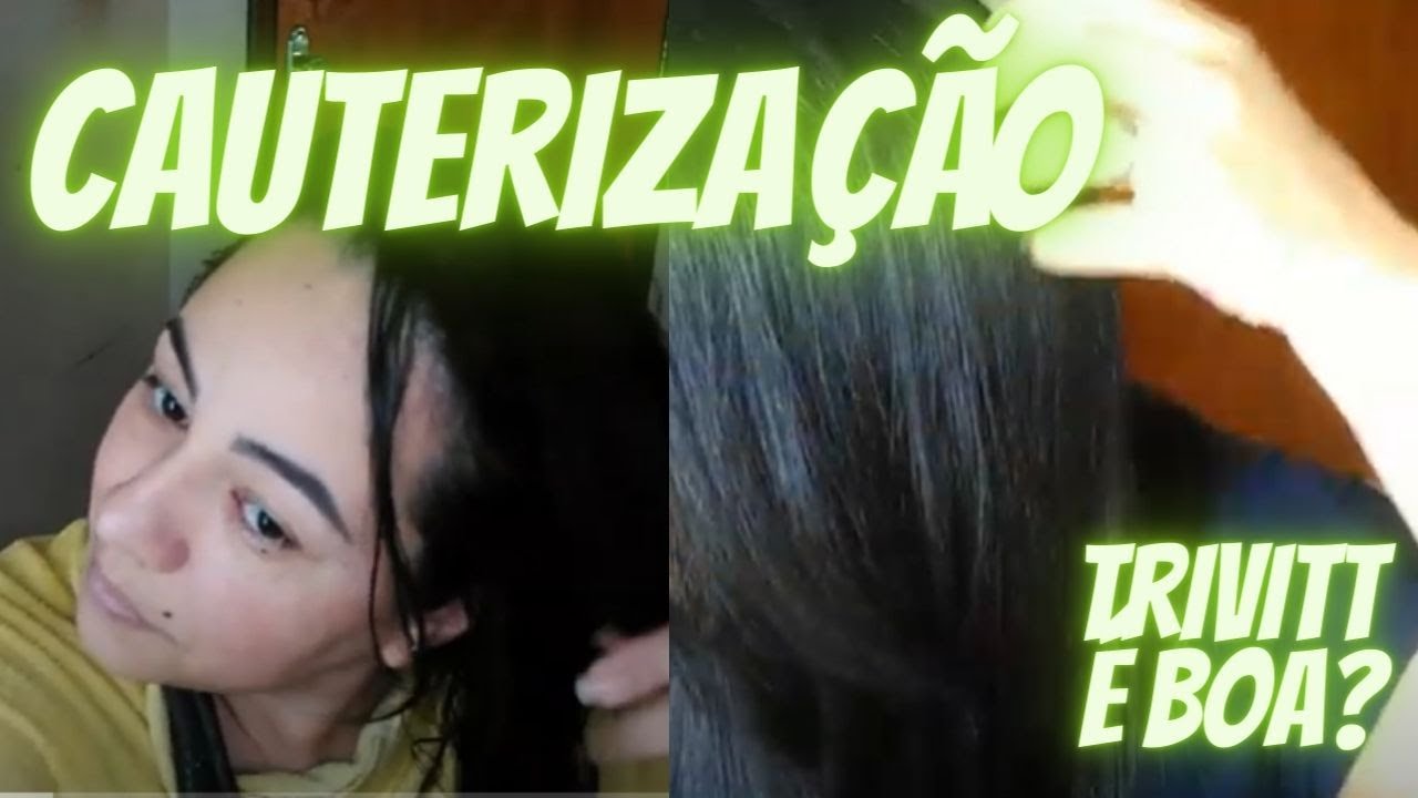 CAUTERIZA&Ccedil;&Atilde;O TRIVITT PASSO A PASSO | CAUTERIZA&Ccedil;&Atilde;O TRIVITT COMO FAZER | TRIVITT &Eacute; BOA? COMO USAR