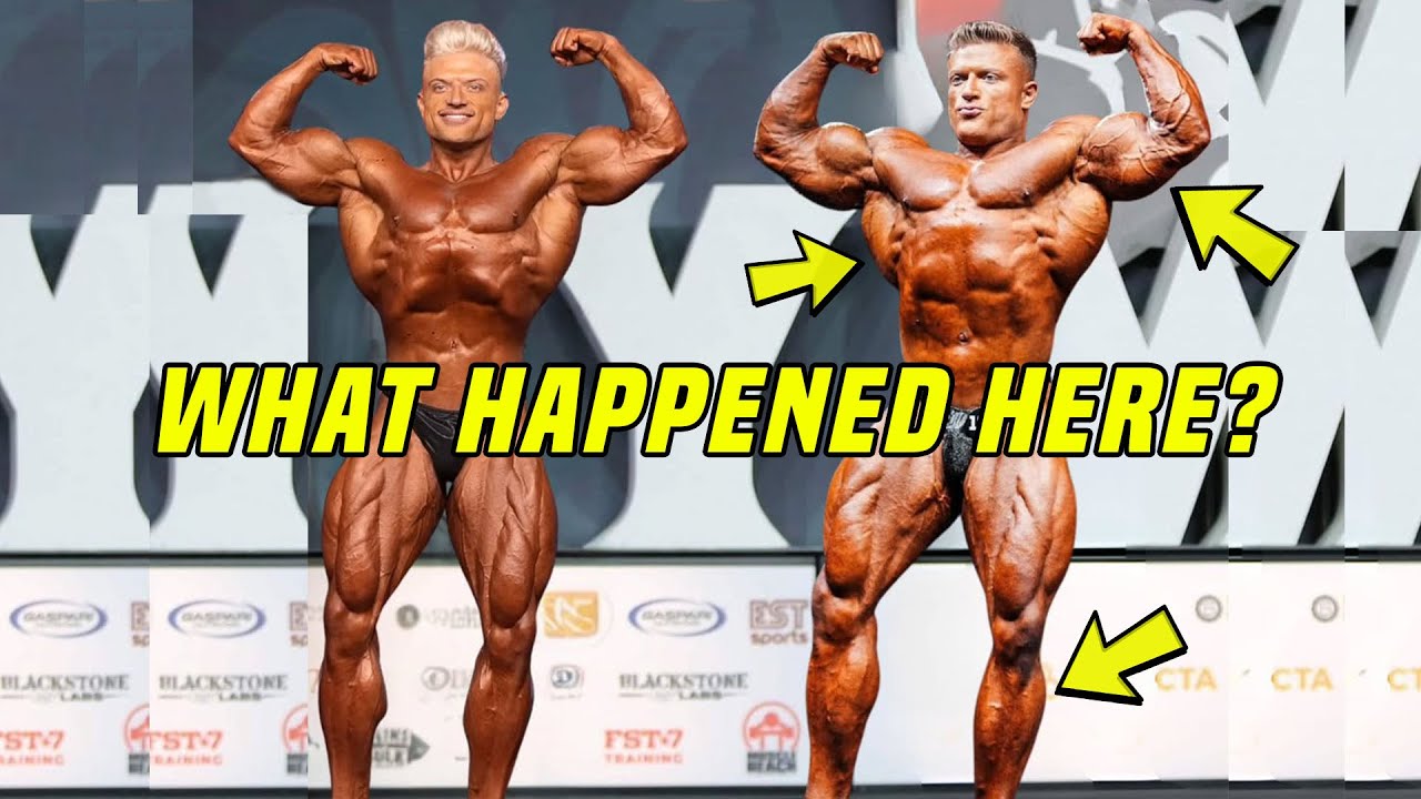 What Exactly Happeneed to Urs Kalecinski's Physique??