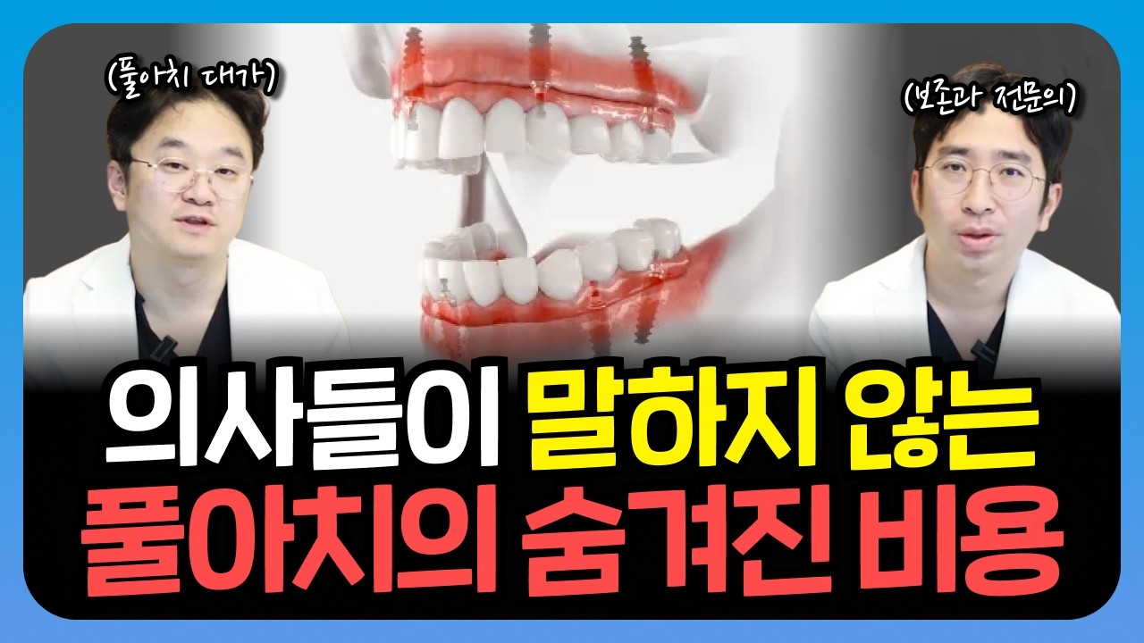 풀아치 임플란트 가격? &lsquo;이것&rsquo; 모르면 2배 더 냅니다