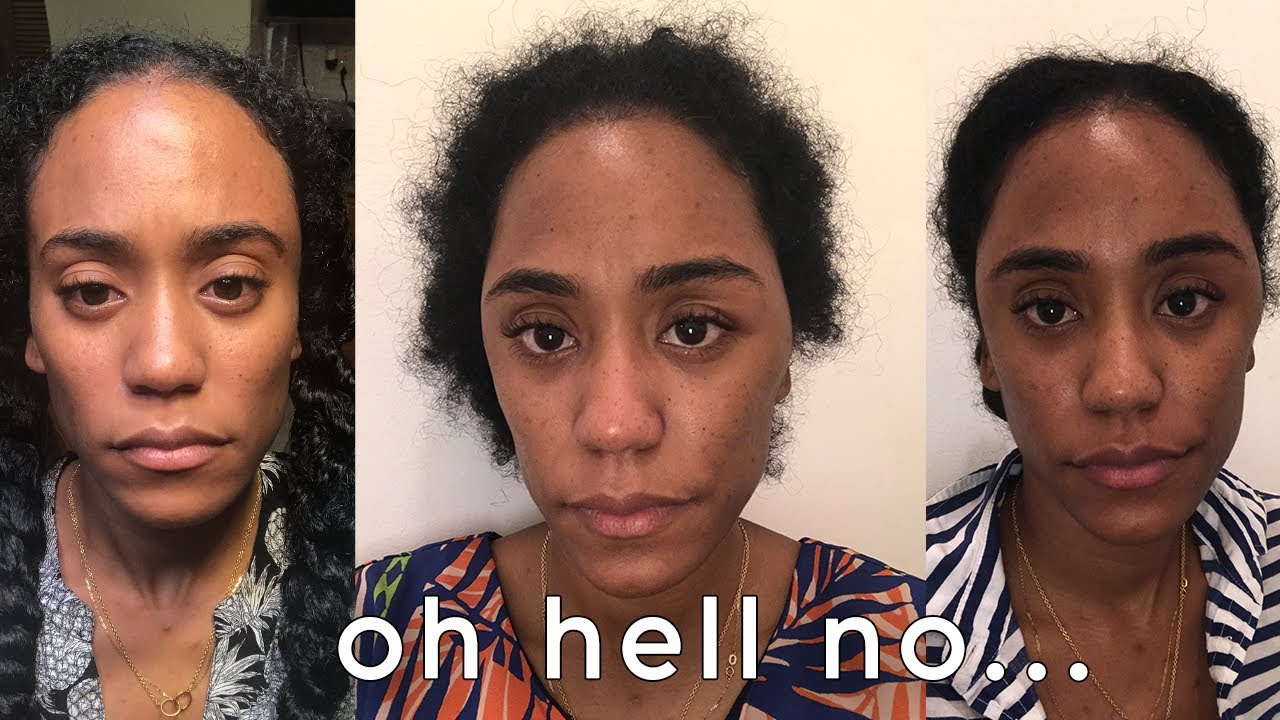 Hair Dye Allergy Almost Sent Me To The ER!!!!
