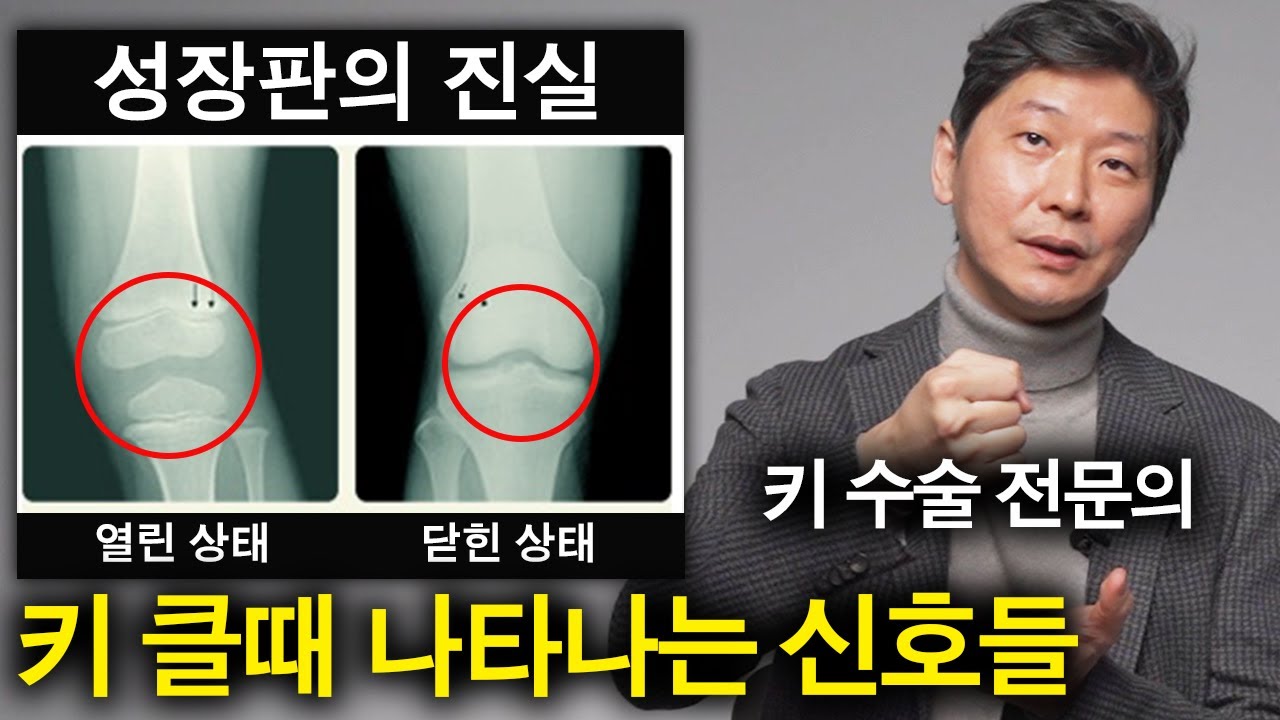 키가 크는데 가장 중요한 것들 (유전자 극복하는 법)