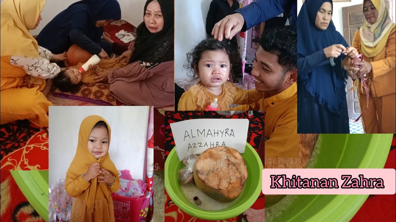 Alhamdulillah khitanan(sunatan) anak perempuan aku berjalan lancar, 