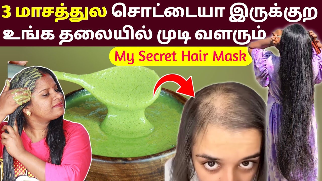OMG..😱 HAIR FALL🔥1 முடிக்கு 10 முடி கொட்டுத்தா..? இனி கொட்டாது♥️ Hair fall solution / Baldness tips