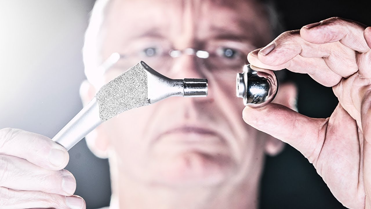 Hip Implants Causing SEVERE Metal Poisoning In Patients