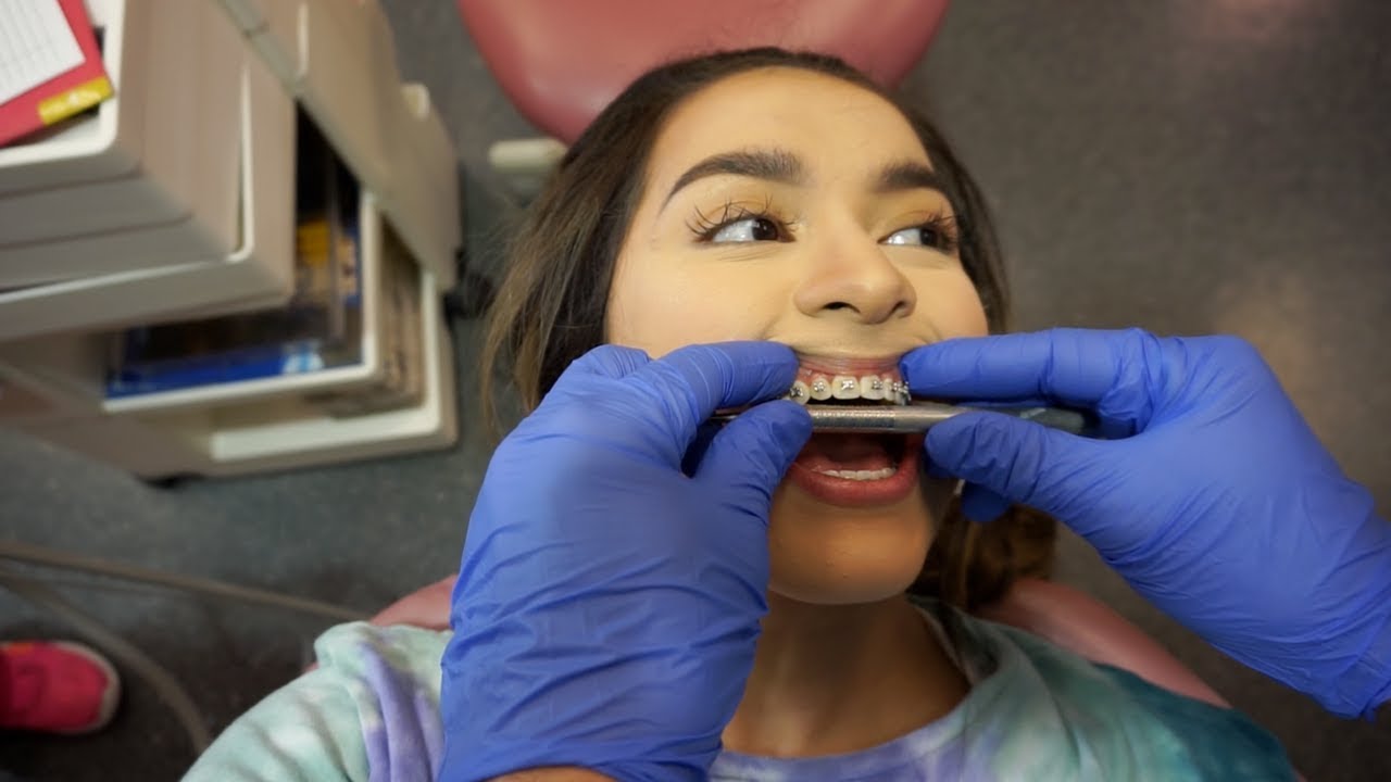 BRACES ARE COMING OFF SOON
