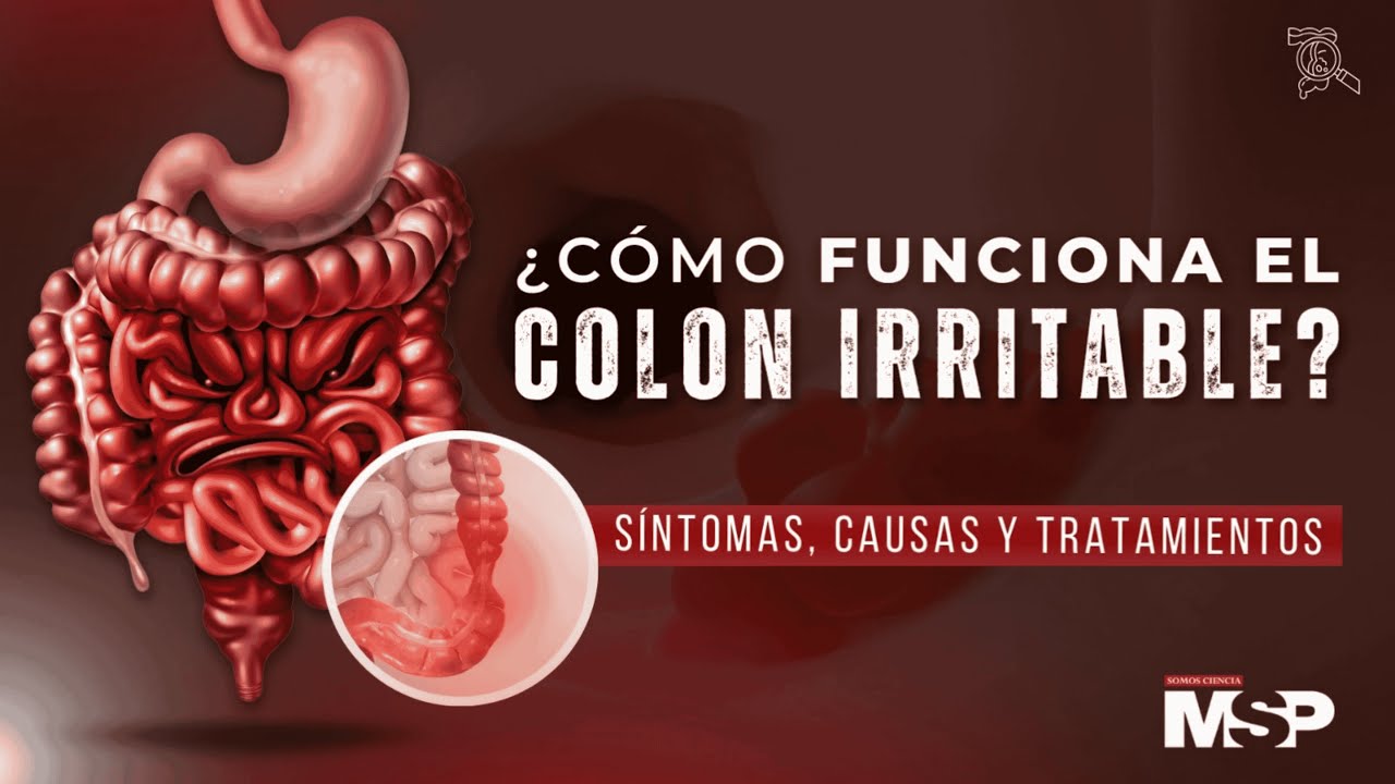 &iquest;C&oacute;mo funciona el colon irritable? S&iacute;ntomas, causas y tratamientos- #ExclusivoMSP