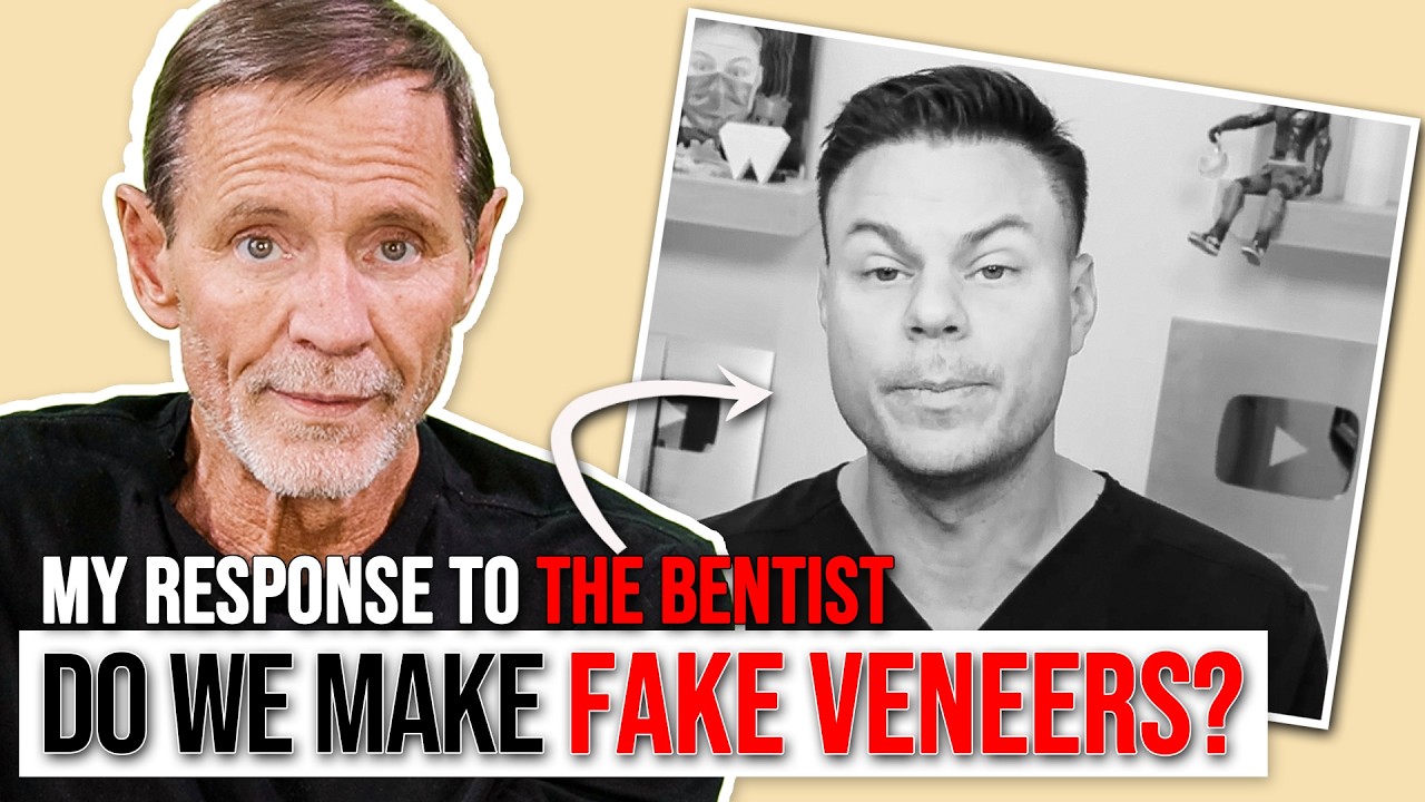 BEST Fake Snap On Veneers? A Response to @The Bentist
