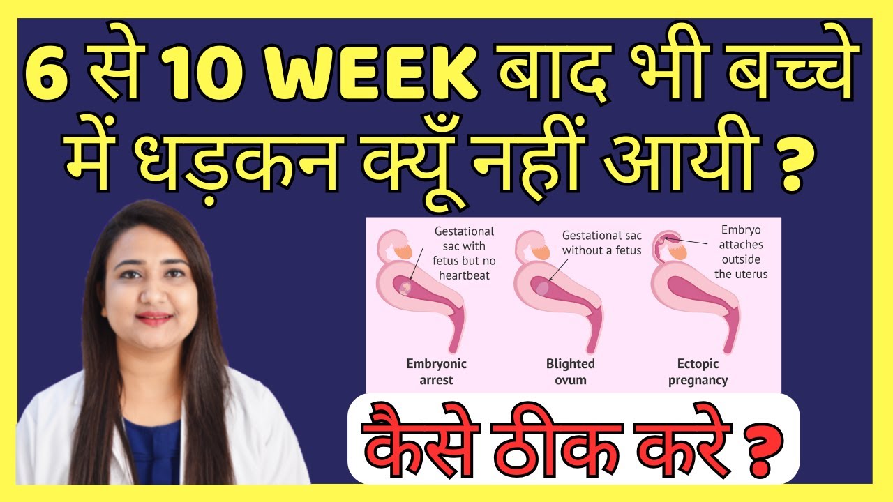 6 से 10 WEEK बाद भी बच्चे में धड़कन क्यूँ नहीं आयी ? कैसे ठीक करे ? BABY HEARTBEAT IN PREGNANCY