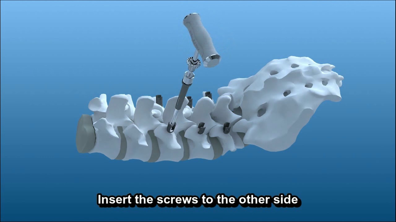 Spine user guide