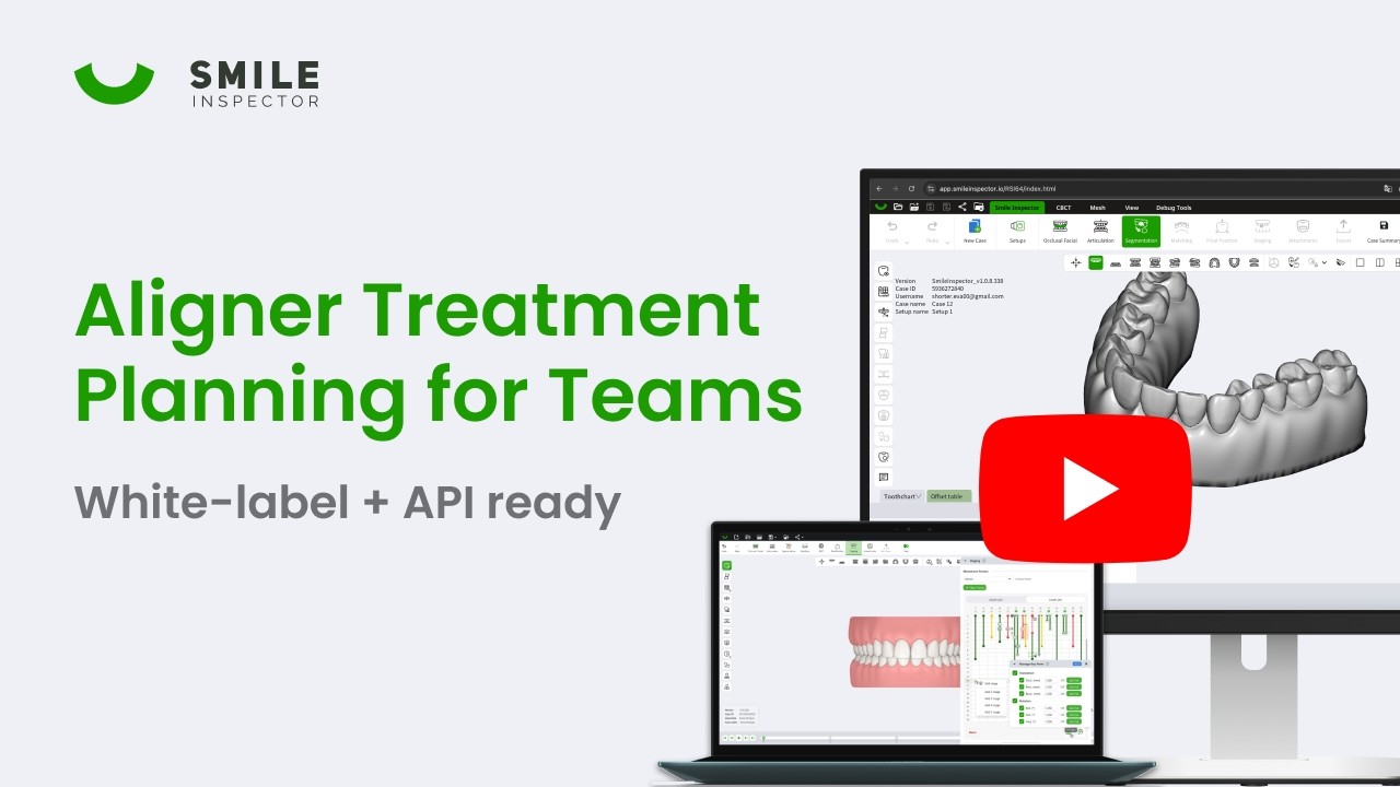 SmileInspector: Cross-Platform Aligner Treatment Planning for Windows, macOS, Linux, Web
