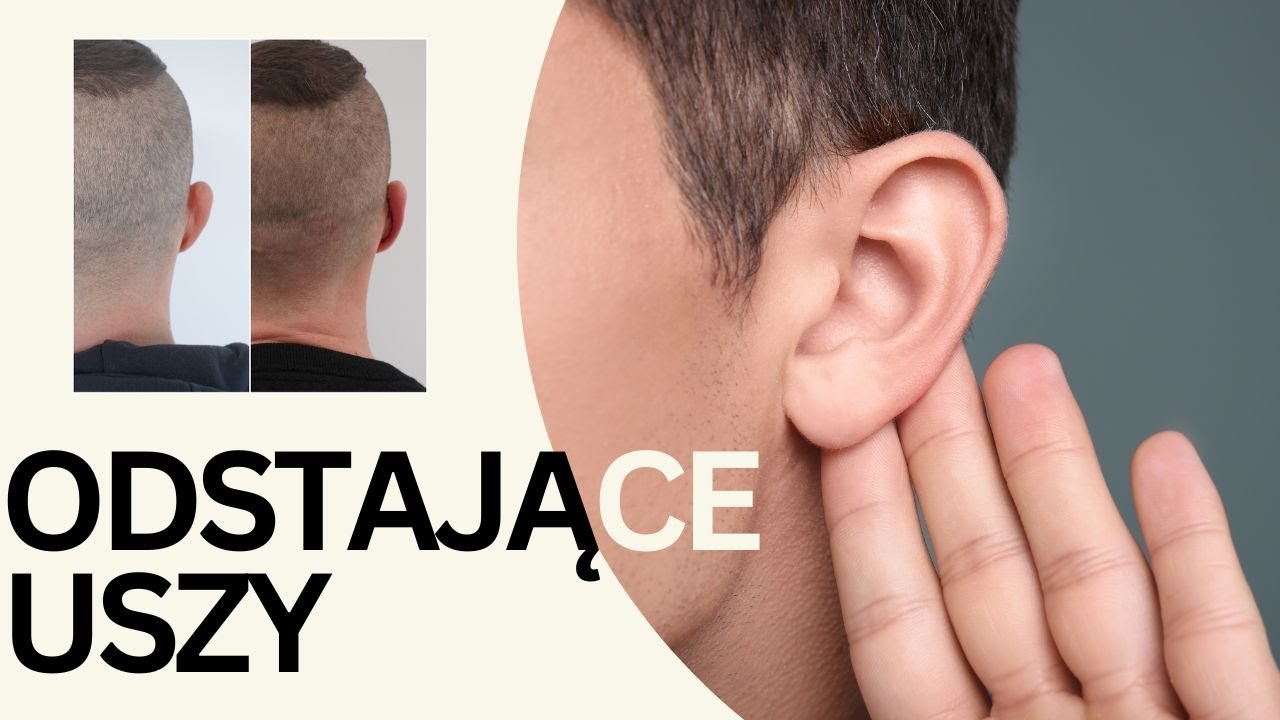 Odstające Uszy - Korekta Uszu w Medycynie Estetycznej  - OT.CO Clinic
