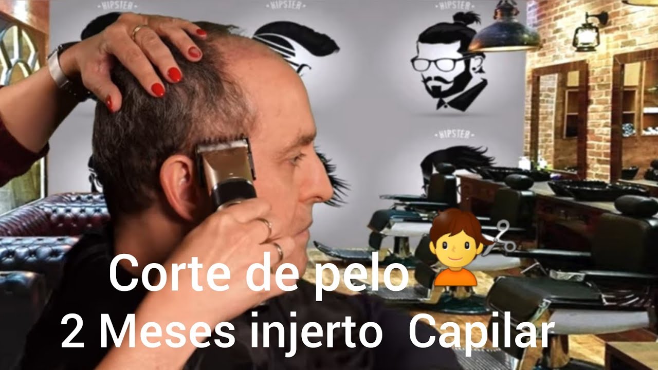 💇‍♂️CORTE DE PELO💇‍♂️ 2 MESES INJERTO CAPILAR!!!