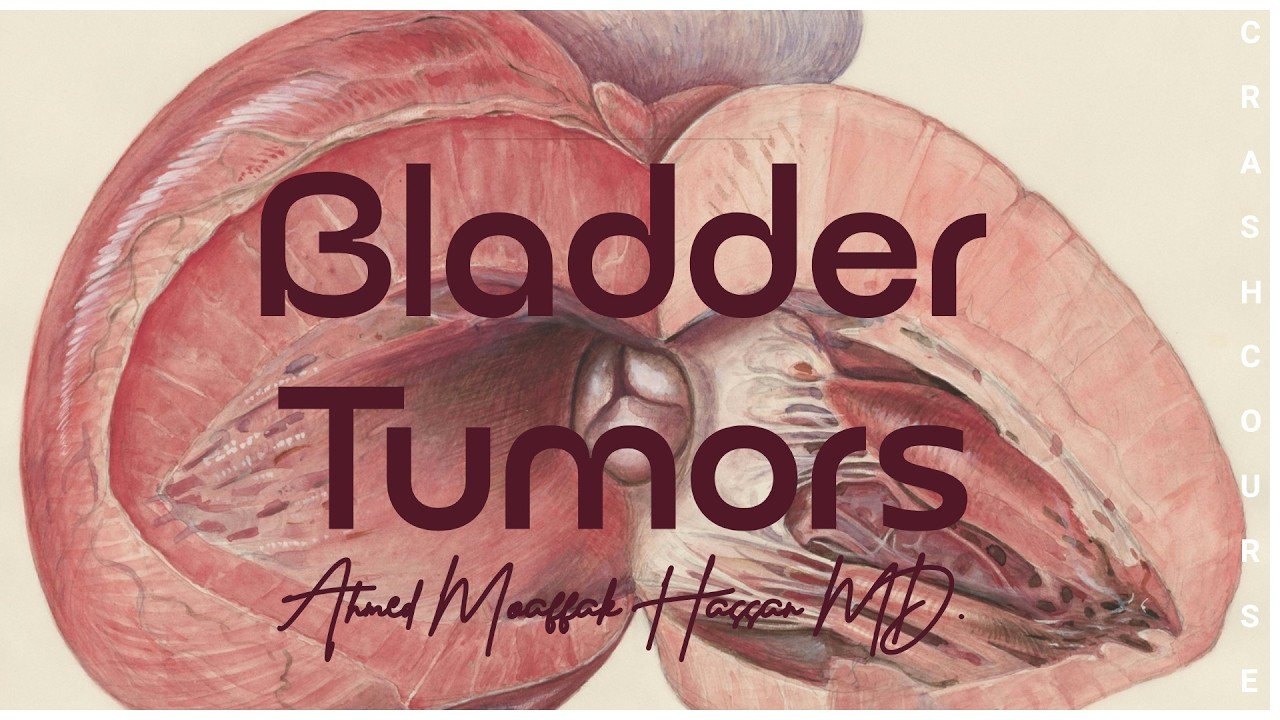 Bladder Tumors - Part 1