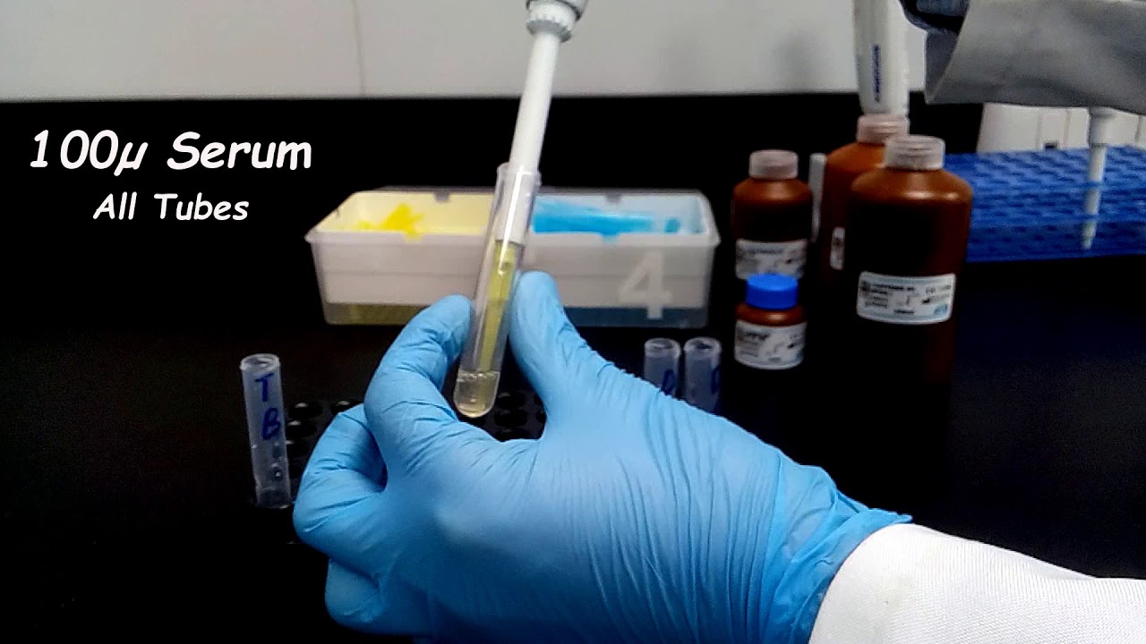 تحليل الصفراء عملي (Bilirubin T&D) على جهاز (Phototron)